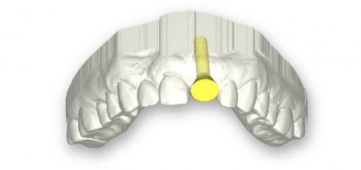 dental_4