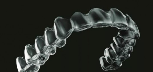 Dental_Invisalign_appliance